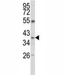 Arginase 1 Antibody (ARG1)