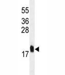 MCFD2 Antibody, 0.4ml