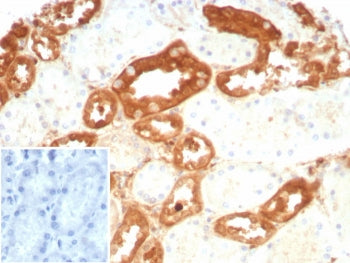 IHC staining of FFPE human kidney tissue with recombinant GSTM3 antibody (clone rGSTM3/8878). Inset: