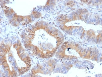 hCG Receptor / LH Receptor Antibody