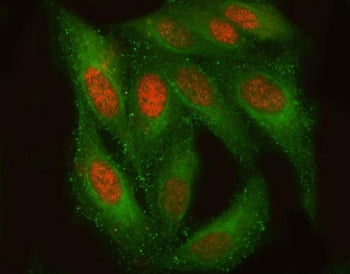 TM2D3 Antibody / BLP2