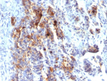MUC5AC Antibody / Mucin 5AC