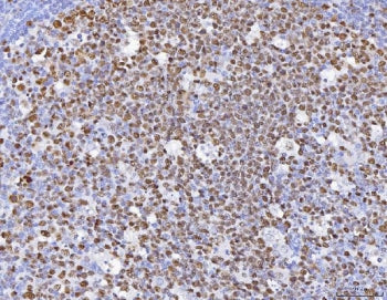 IHC staining of FFPE human tonsil with MCM6 antibody. HIER: boil tissue sections in pH8 EDTA for 20 