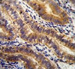 IHC testing of FFPE human uterus tissue with Angiopoietin 2 antibody. HIER: steam section in pH6 cit