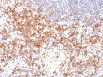 IHC testing of FFPE human lymph node with recombinant CD27 antibody (clone LPFS2/2034R). Required HI