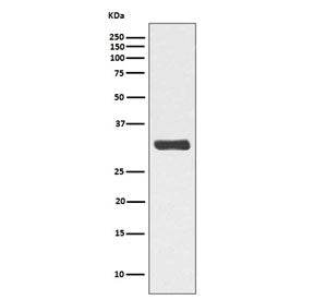 Western blot testing of lysate from human HeLa cells treated with Calyculin A, with phospho-RPA32 an