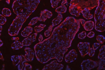 SSR3 Antibody
