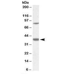 Western blot testing of frontal cortex lysate with LASS1 antibody at 1ug/ml. The expected ~37kDa ban