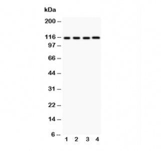 NALP3 Antibody (NLRP3)