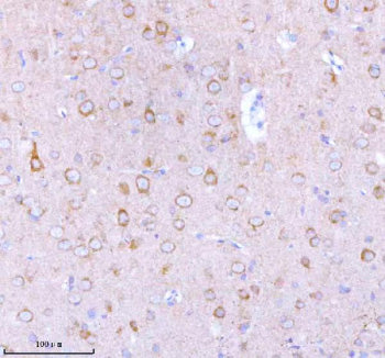 Immunohistochemical staining of STXBP6 using anti-STXBP6 antibody. STXBP6 was detected in a paraffin