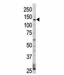 Western blot analysis of ErbB4 / HER4 antibody and HL-60 cell lysate. Predicted molecular weight: 14