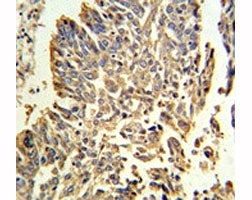 HSP27 Antibody (HSPB1)