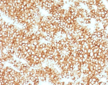 IHC testing of FFPE human parathyroid gland stained with recombinant Parathyroid Hormone antibody (c