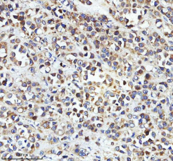 Immunohistochemical staining of STRIP2 using anti-STRIP2 antibody. STRIP2 was detected in a paraffin
