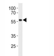 p53 Antibody