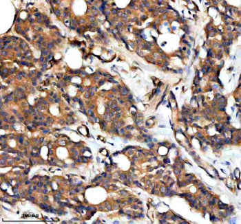 Immunohistochemical staining of RAPH1 using anti-RAPH1 antibody. RAPH1 was detected in a paraffin-em