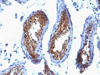 IHC: Formalin-fixed, paraffin-embedded human testicular carcinoma stained with MVP antibody (clone S