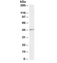 Western blot testing of Jurkat lysate with TDP-43 antibody at 0.3ug/ml. Predicted molecular weight ~