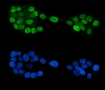 Immunofluorescent staining of FFPE human A431 cells with GATA6 antibody (green) and DAPI nuclear sta