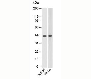 Western blot testing of human samples with beta Actin antibody at 1 ug/ml.