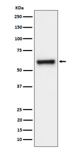 Western blot analysis of FPGS expression in human HeLa cell lysate using FPGS antibody. Predicted mo