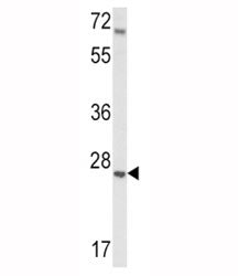 Western blot analysis of IGFBP4 antibody and mouse lung tissue lysate. Predicted molecular weight: ~