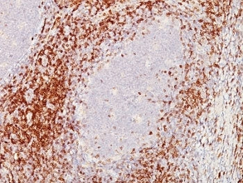 CD5 Antibody Cocktail