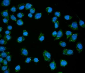 Immunofluorescent staining of FFPE human SiHa cells with EDC4 antibody (green) and DAPI nuclear stai