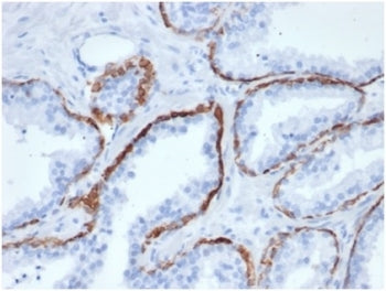 Cytokeratin 5 Antibody / KRT5