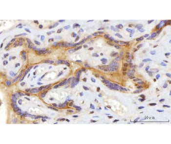 CEP250 Antibody / Centrosomal protein 2