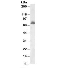 AKAP10 Antibody