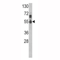 Western blot analysis of IL17RB antibody and MDA-MB468 lysate.