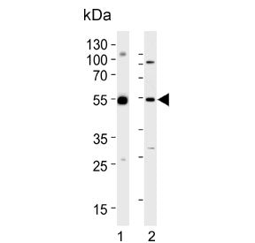 Western blot testing of human 1) U-251 MG and 2) PC-3 cell lysate with DEK antibody. Expected molecu