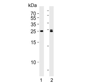 Western blot testing of human 1) K562 and 2) Daudi cell lysate with MOB kinase activator 1B antibody