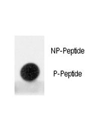 MDM2 Antibody (phospho-S395)