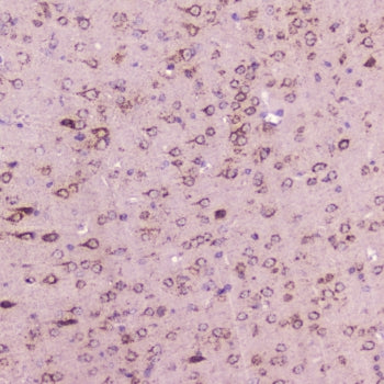 IHC testing of FFPE mouse brain with Calcitonin antibody at 2ug/ml. HIER: steamed antigen retrieval 