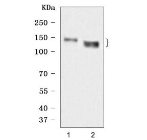 Desmoglein 3 Antibody