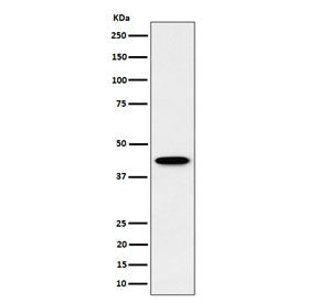 Western blot testing of human HepG2 cell lysate with Inositol-tetrakisphosphate 1-kinase antibody. P