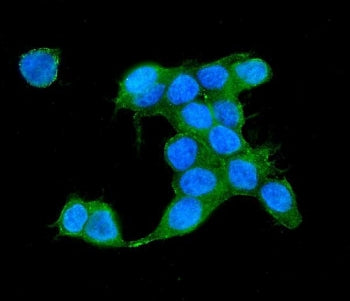 Immunofluorescent staining of FFPE human MCF7 cells with IQGAP2 antibody (green) and DAPI nuclear st