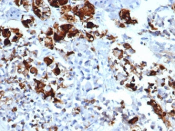 Prolactin Antibody / PRL
