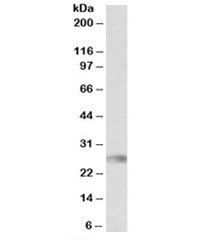 Western blot testing of human bone marrow lysate with HLA-DQA2 antibody at 0.3ug/ml. Predicted molec