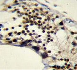 IHC testing of FFPE human testis tissue with Rac GTPase-activating protein 1 antibody. HIER: steam s