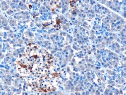 IHC testing of FFPE human pancreas with MDA-5 antibody at 10ug/ml. HIER: Microwave with pH9 Tris/EDT