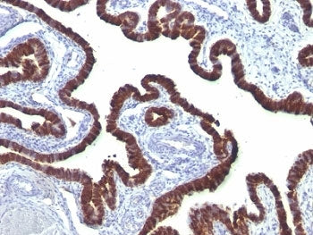 KRT7 Antibody / Cytokeratin 7