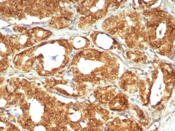 IHC staining of FFPE human prostate tissue with MIF antibody (clone MIF/6280). HIER: boil tissue sec