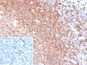 IHC staining of FFPE human tonsil tissue with CD185 antibody (clone CXCR5/8279R). Inset: PBS used in