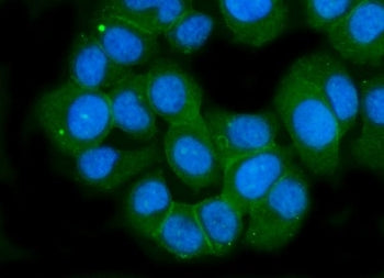 GLUR2 Antibody