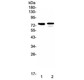 Western blot testing of human 1) SK-OV-3 and 2) Jurkat lystate with FZD3 antibody at 0.5ug/ml. Predi