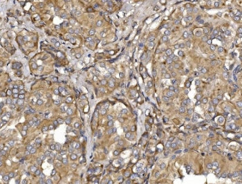 MEFV Antibody / Marenostrin / Pyrin