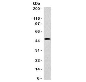 Western blot testing of human HT29 cell lysate with KRT20 antibody (clone CTKN20-1). Predicted molec